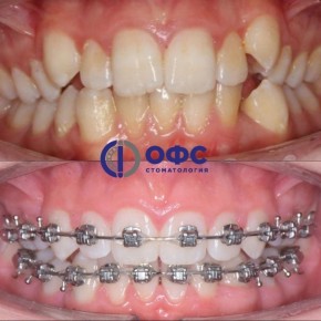 � ������� � �����: ��� ������������ ����� �������� ���� �����